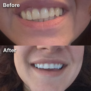 Avis client